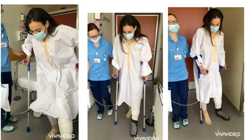 Teo Meluță a postat imaginile cu fractura care a dus-o pe masa de operație: „Mă așteaptă un drum lung și greu!” | FOTO & VIDEO