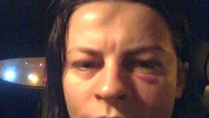 Când viața în familie se transformă într-un meci de box. Imagine șocantă publicată de soția uniui politician PNL. "Antrenament de soție..."