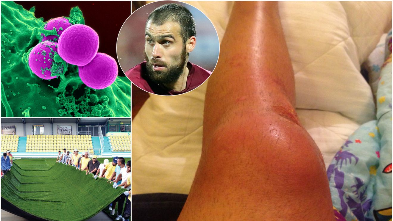 FOTO ȘOCANT | Maftei a fost operat după o infecție cu o bacterie periculoasă, după o alunecare pe gazonul artificial. "Sunt bine, dar să vedem cum reacționează piciorul"