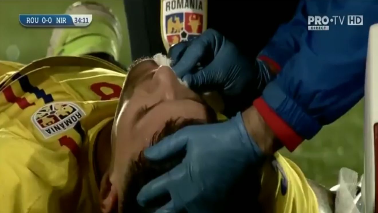 Fază horror în România U21 - Irlanda de Nord U21. Dennis Man a stat 5 minute pe jos după ce a fost făcut K.O.