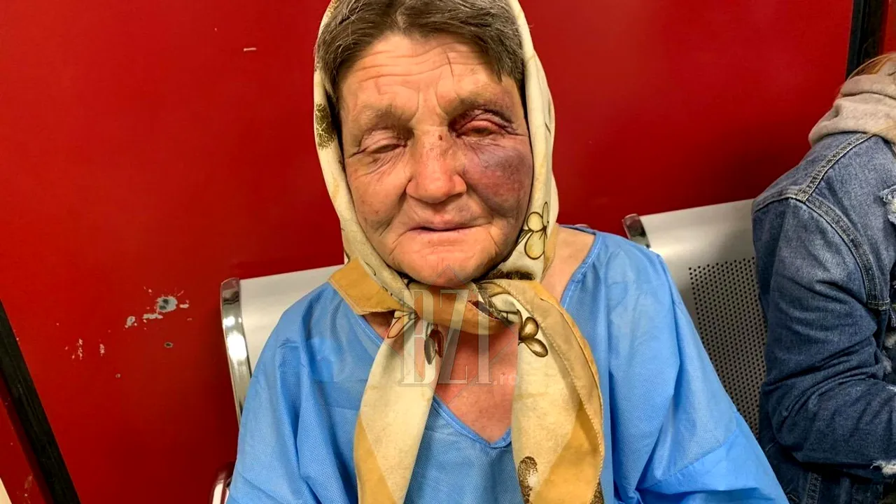 Bătrână, snopită în bătaie de 3 tineri, în gara din Iași. Femeia a ajuns de urgență la spital, cu răni pe tot corpul! 
