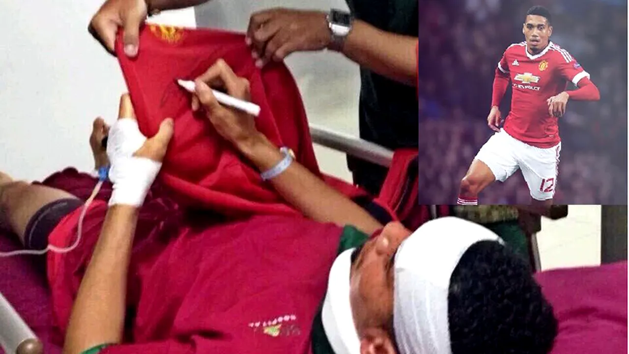 FOTO | Chris Smalling a ajuns la spital după ce a suferit un accident în vacanță