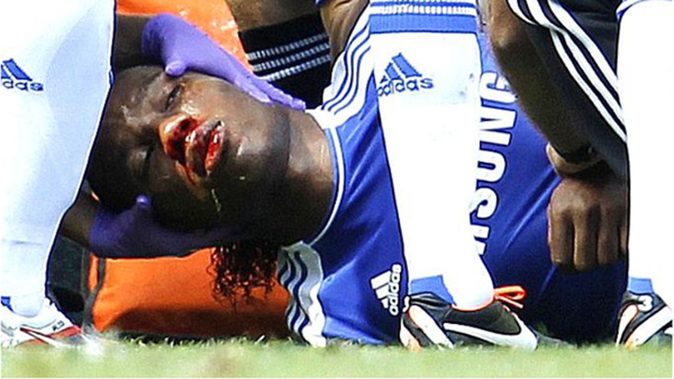 Drogba, primul interviu după accidentarea HORROR:** "Mă sperii când văd imaginile cu mine plin de sânge"