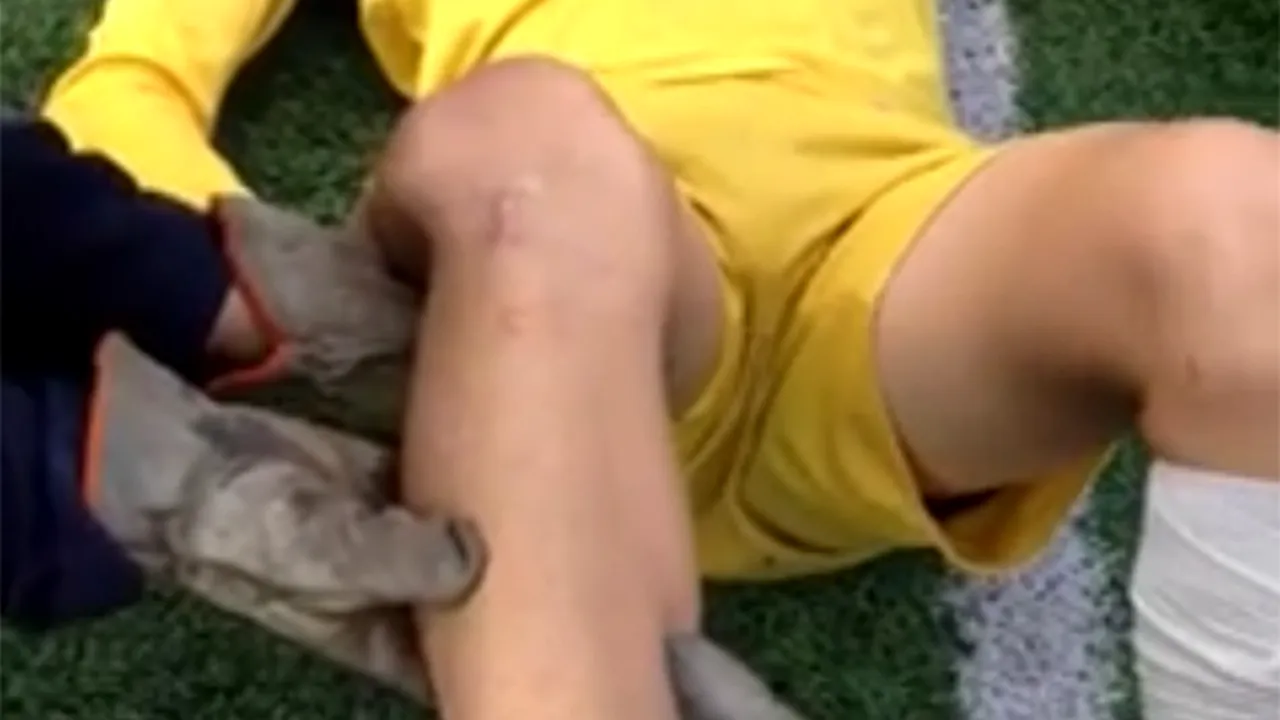 VIDEO ȘOCANT | Un fotbalist amator a suferit o accidentare teribilă: paramedicii i-au pus genunchiul la loc chiar pe teren