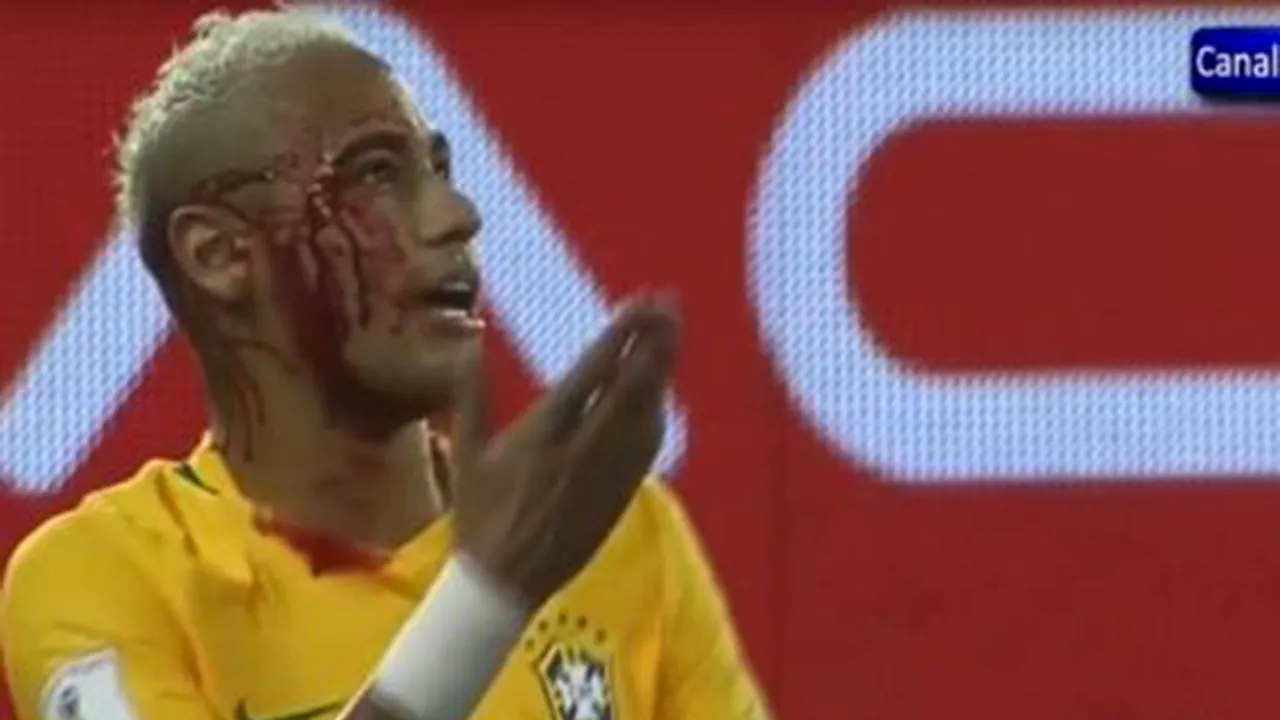 VIDEO | Neymar a încercat să-i treacă mingea printre picioare unui adversar și s-a ales cu arcada spartă