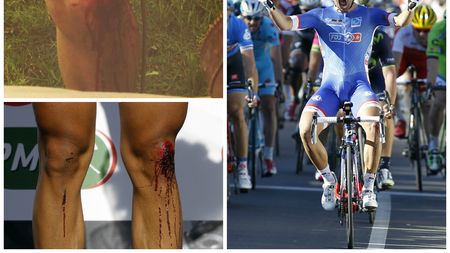 VIDEO - Victorie cu genunchii însângerați. Bouhanni s-a impus în prima etapă din Paris-Nisa, deși a căzut serios 