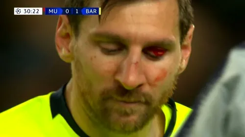 Messi, probleme serioase după ce Smalling l-a umplut de sânge