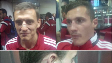 "Stewarzii au sărit să ne bată". Ca după război! FOTO - Rănile suferite de jucătorii Albaniei după "războiul" de la Belgrad. Fotbaliștii, primiți ca niște eroi la revenirea la Tirana | VIDEO