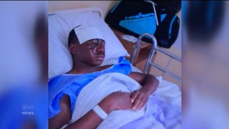 VIDEO | E inuman! Dramă fără margini pentru un tânăr fotbalist irlandez: a fost orbit cu acid, în urma unui atac sălbatic. Imagini cu un puternic impact emoțional