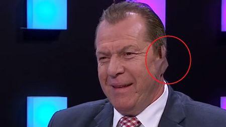 FOTO | Duckadam a surprins pe toată lumea după ce a apărut la TV așa! Motivul pentru care a făcut acest gest: "Nu a fost dureros" :)