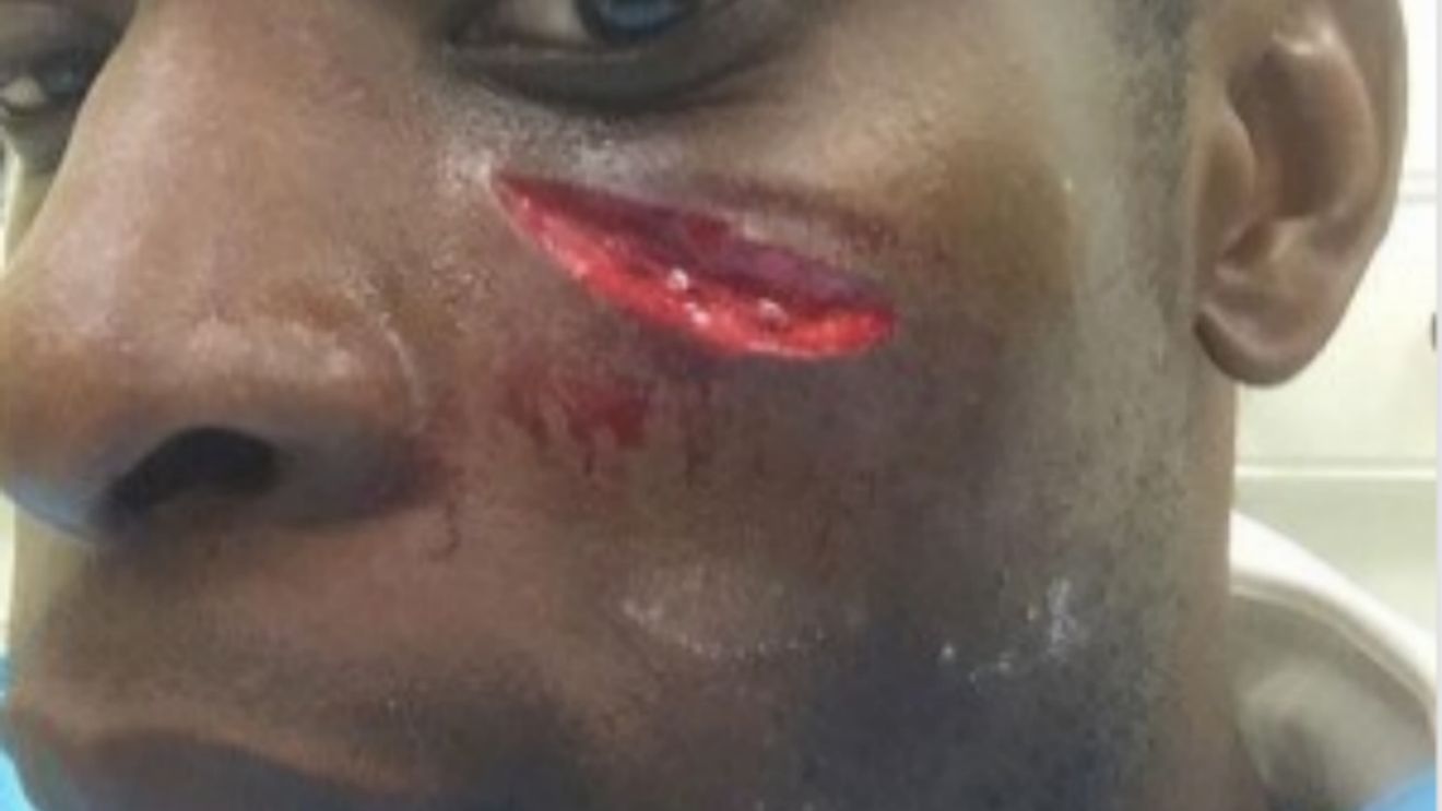 Accidentare teribilă în Premier League, la ultimul meci al lui Arsenal. FOTO teribil | Cum a ajuns fundașul să arate așa