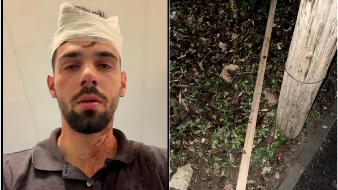 Scene incredibile la Timișoara! Doi fotbaliști care aparțin de Știința Poli, implicați într-o bătaie cruntă aplicată copilului unui fost fotbalist la clubul alb-violet