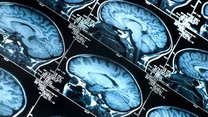 Descoperire șocantă pe creierul unui jucător decedat la 27 de ani. Afecțiunea gravă care riscă să compromită un sport de miliarde de dolari 