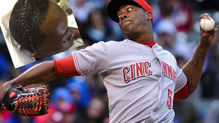 Desfigurat de o minge care a atins 100 km/h. FOTO - Cum arată acum jucătorul de baseball