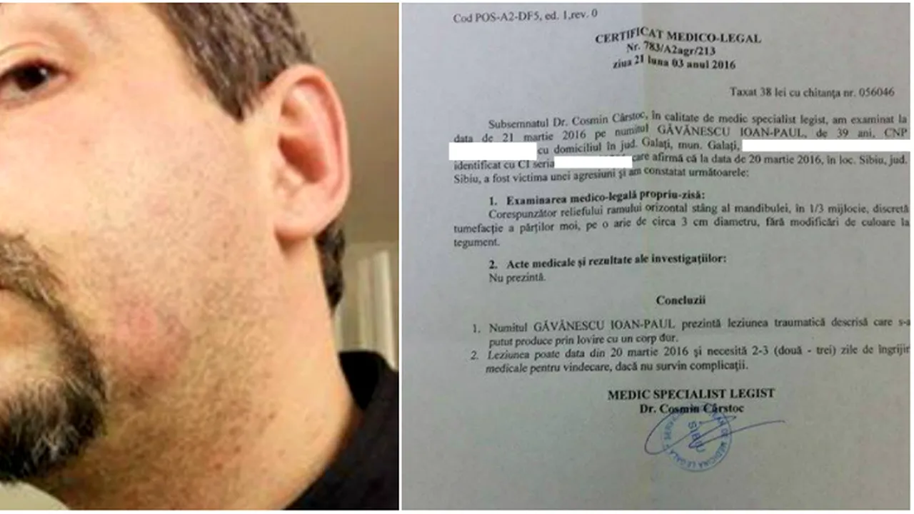FOTO EXCLUSIV | Bărbatul care susține că a fost bătut de directorul unui turneu de tenis și-a scos certificat medico-legal. 