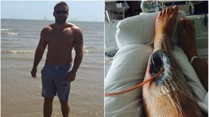 TERIFIANT | Un bărbat s-a "prăjit" pe interior după ce a luat "fat burners". Biochimistul Graziela Vâjâială: "Sunt suplimente pentru accelerarea metabolismului lipidic". În România, aceste substanțe se vând fără rețetă, iar legea care le reglementează stă în Parlament