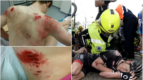VIDEO + FOTO | Ce înseamnă o căzătură în ciclism. Care sunt urmările unuia dintre cele mai teribile incidente din plutonul profesionist din ultimii ani