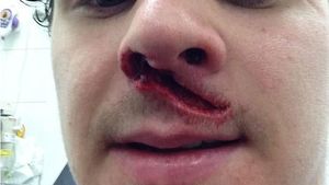 FOTO Imagini de groază care îți taie respirația!** A rămas șocat când s-a văzut în oglindă! Cum a ajuns în această stare