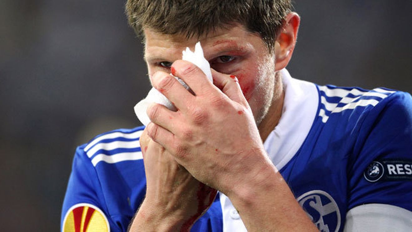 Așa joacă AEK Larnaca șansa pentru primăvara EL!** Huntelaar, suspect de fractură de piramidă, Marica zâmbește iar