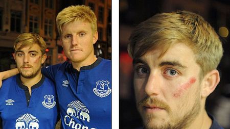 Incidente grave înainte de Lille - Everton. Suporterii englezi au fost atacați de 100 de ultrași francezi