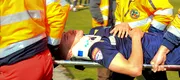 INTERVIU cu Cătălin Itu, fotbalistul făcut KO în derby-ul Moldovei: ”Eram cu ochii închiși, auzeam câteva voci în jur și voiam să continui meciul.” Ce a simțit jucătorul Iașiului în momentul în care Ghiocel l-a lovit cu crampoanele și cum arată acum fața sa