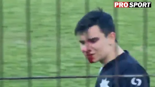Scene șocante în fotbalul românesc! Jucătorii s-au bătut până la sânge la derby-ul pentru promovare | VIDEO
