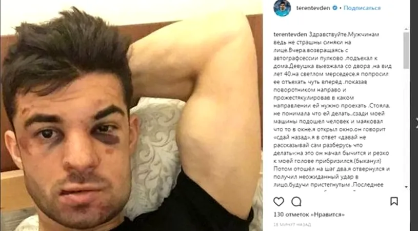 Violență fără margini în Rusia! Un fotbalist de la Zenit a fost bătut în plină stradă dintr-un motiv absurd | FOTO