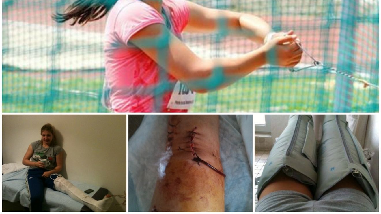 Lacrimi de sânge. Genunchiul traumatizat și cicatricea de 15 centimetri. "Trei zile și trei nopți n-am închis un ochi" FOTO 