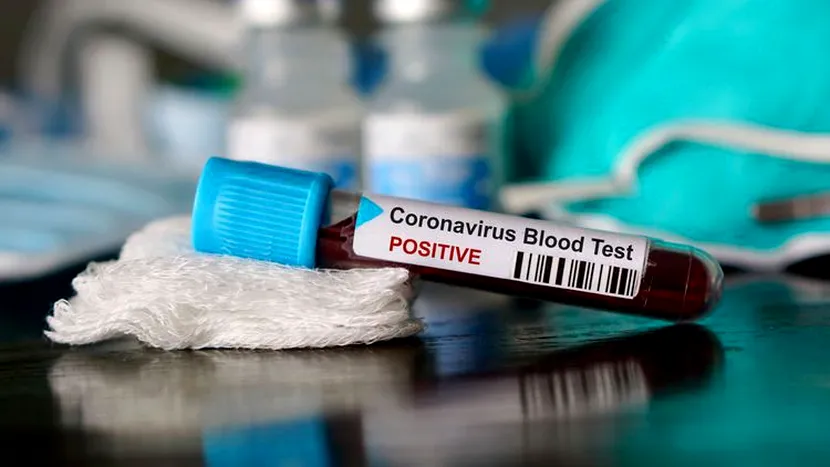 Antidotul pentru coronavirus, găsit de olandezi. Ce spun cercetătorii