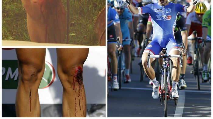 VIDEO - Victorie cu genunchii însângerați. Bouhanni s-a impus în prima etapă din Paris-Nisa, deși a căzut serios 