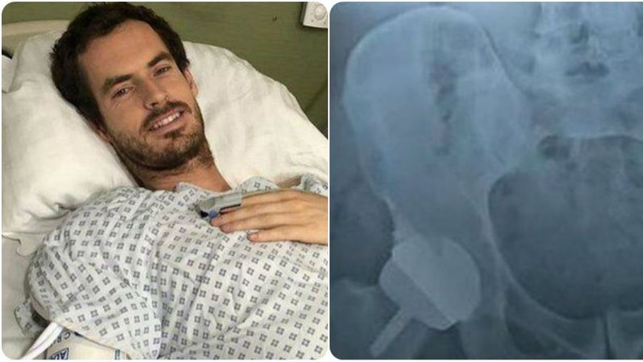 Andy Murray, operat la Londra: "Acum am un șold metalic" | FOTO