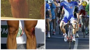 VIDEO - Victorie cu genunchii însângerați. Bouhanni s-a impus în prima etapă din Paris-Nisa, deși a căzut serios 