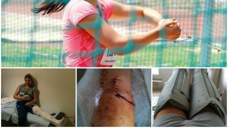 Lacrimi de sânge. Genunchiul traumatizat și cicatricea de 15 centimetri. "Trei zile și trei nopți n-am închis un ochi" FOTO 