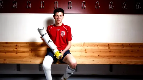 Lecția unui fotbalist de 22 de ani. Cum să lupți pentru ceea ce te face fericit. A fost primul jucător care a primit acceptul FIFA de a evolua cu proteză, dar cancerul l-a învins: 