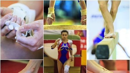 FOTO | Cicatrici de campioană. Povestea neștiută a unei medalii: operații, bandaje, bătături și mâini însângerate. "Robocop" Bulimar și drumul dureros spre Europenele de la Montpellier
