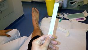 FOTO Cu Marica la infiltrații!** "Tricolorul" a postat poze din timpul tratamentului