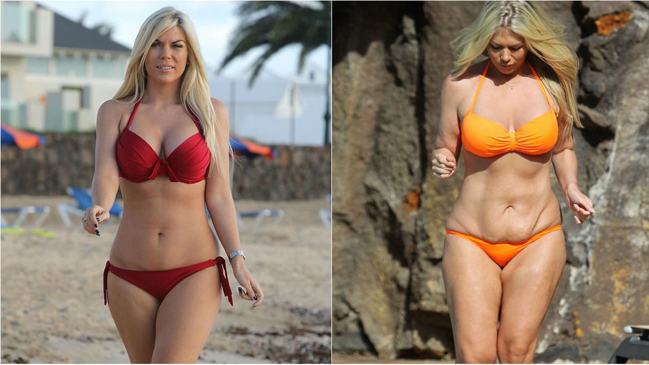 Pericolele dietei dusă la extrem! FOTO INCREDIBIL | Efect "yo-yo" pentru o vedetă de 28 de ani. Cum s-a transformat în 10 luni