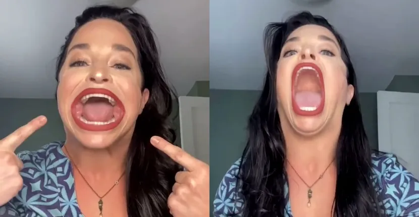 Cum arată femeia cu cea mai mare gură din lume. Aceasta poate mânca un burger uriaș în câteva secunde