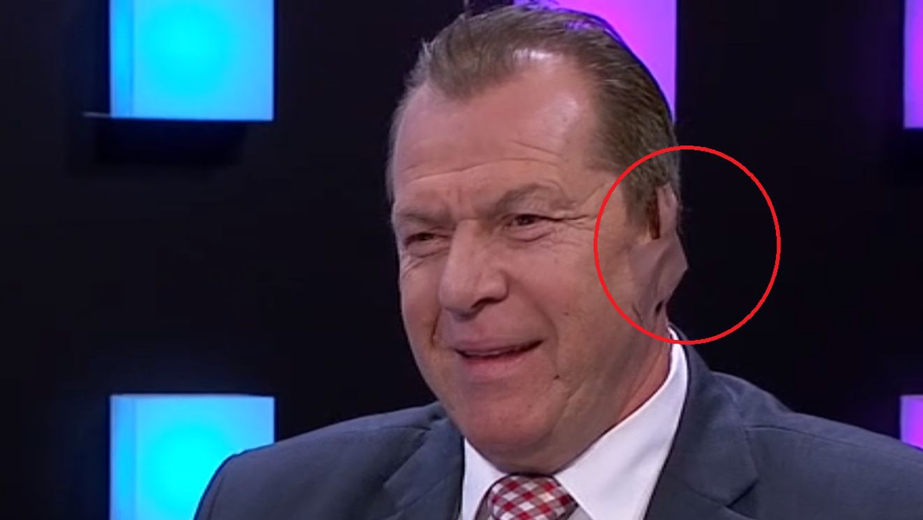 FOTO | Duckadam a surprins pe toată lumea după ce a apărut la TV așa! Motivul pentru care a făcut acest gest: "Nu a fost dureros" :)