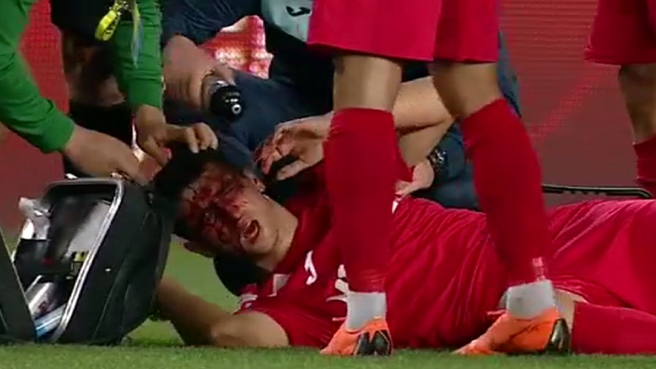 Clipe de groază pe "Ilie Oană". FOTO | Un jucător a rămas întins pe gazon, plin de sânge, în urma unui duel aerian