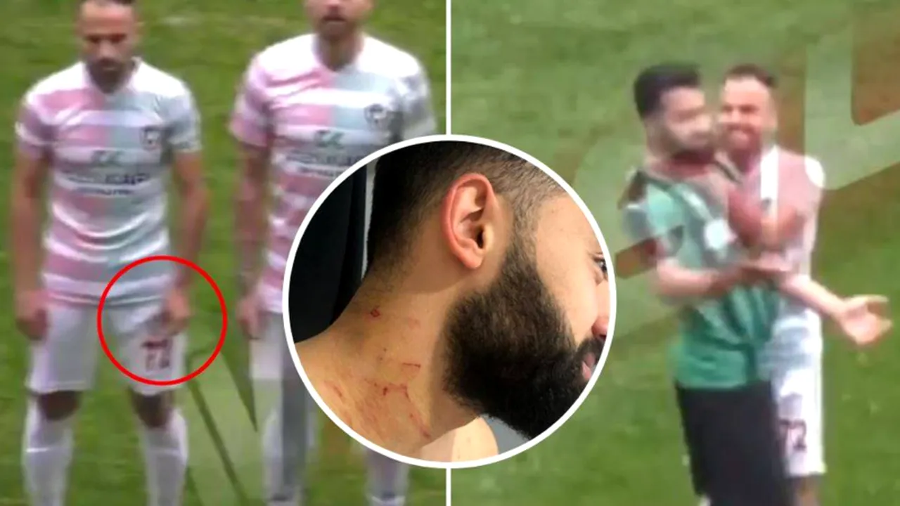Incidente șocante într-un meci din Turcia! VIDEO | Un jucător a fost tăiat cu lama  în timpul jocului