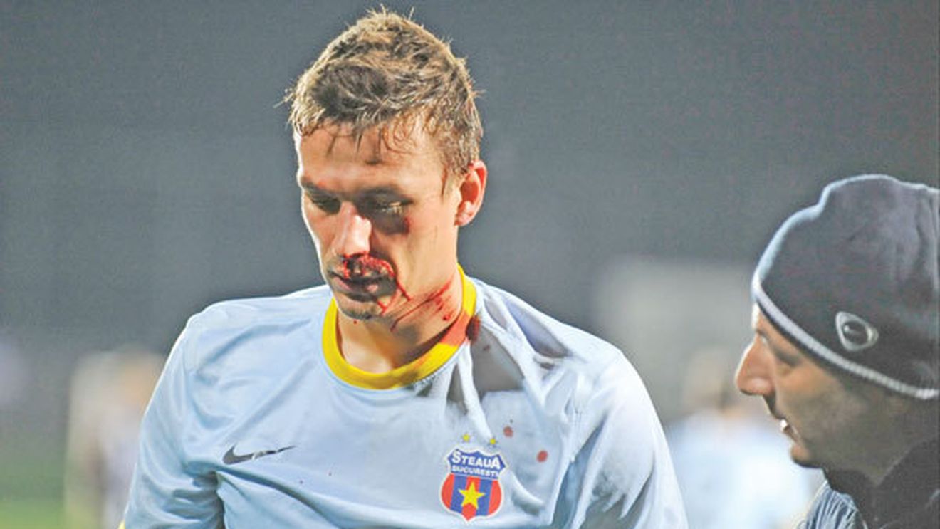 Motiv de bucurie pentru Reghe!** Masca lui Szukala a sosit, polonezul simte că poate juca: "De 5 zile sunt mult mai bine. Un accident  ca ăsta se întâmplă la 4 ani"