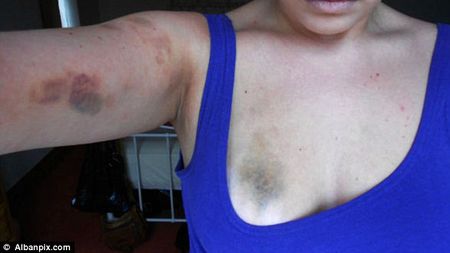 Cum a scăpat un instructor de fitness nepedepsit, după ce și-a bătut măr iubita. FOTO