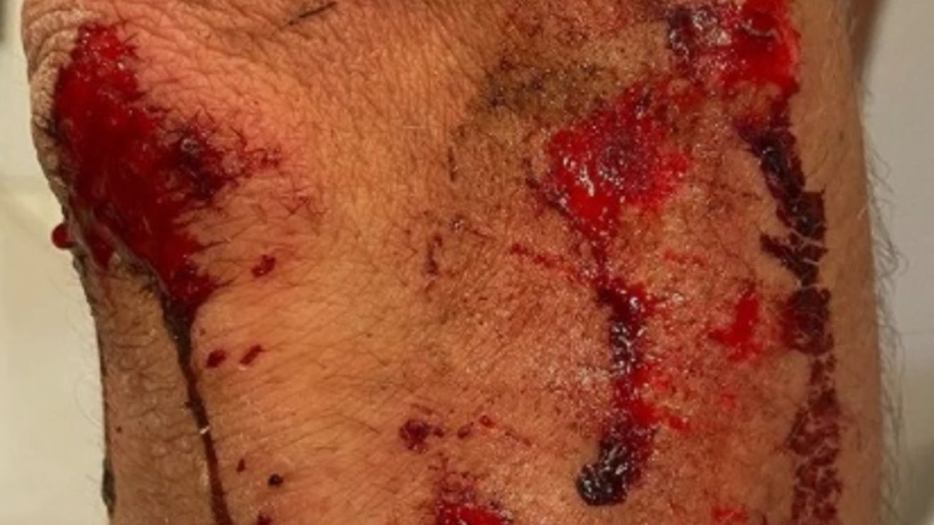 Ciclistul Alexandar Richardson, clipe de coșmar! A fost agresat și jefuit de bărbați mascați: „Au intrat în mine cu motocicleta! Am fost târât o sută de metri!”