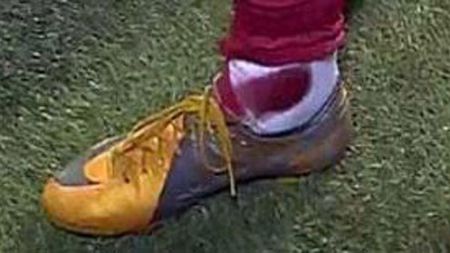 Croații l-au RUPT pe Ronaldo! A terminat meciul de la Zagreb sângerând și huiduit!** Motivul? "Sunt frumos, bogat și bun!"