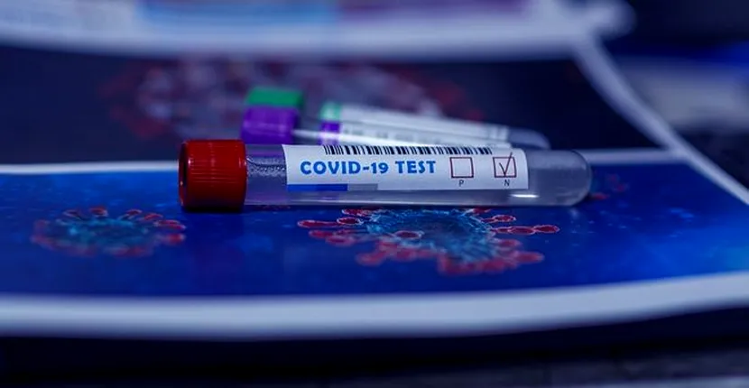 Ce se va întâmpla cu testele de coronavirus dacă numărul cazurilor noi va crește. Alexandru Rafila a făcut anunțul