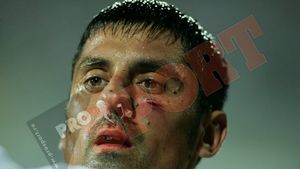 FOTO** Danciu și-a spart pometele!