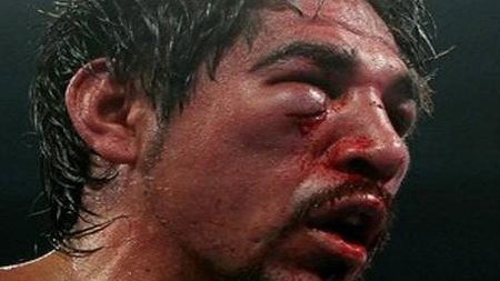 Antonio Margarito, spitalizat după meciul cu Pacquiao!