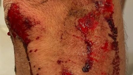 Ciclistul Alexandar Richardson, clipe de coșmar! A fost agresat și jefuit de bărbați mascați: „Au intrat în mine cu motocicleta! Am fost târât o sută de metri!”