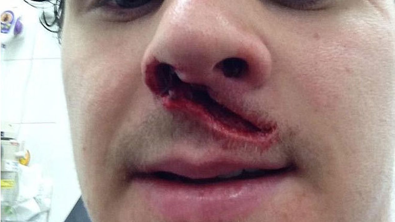 FOTO Imagini de groază care îți taie respirația!** A rămas șocat când s-a văzut în oglindă! Cum a ajuns în această stare